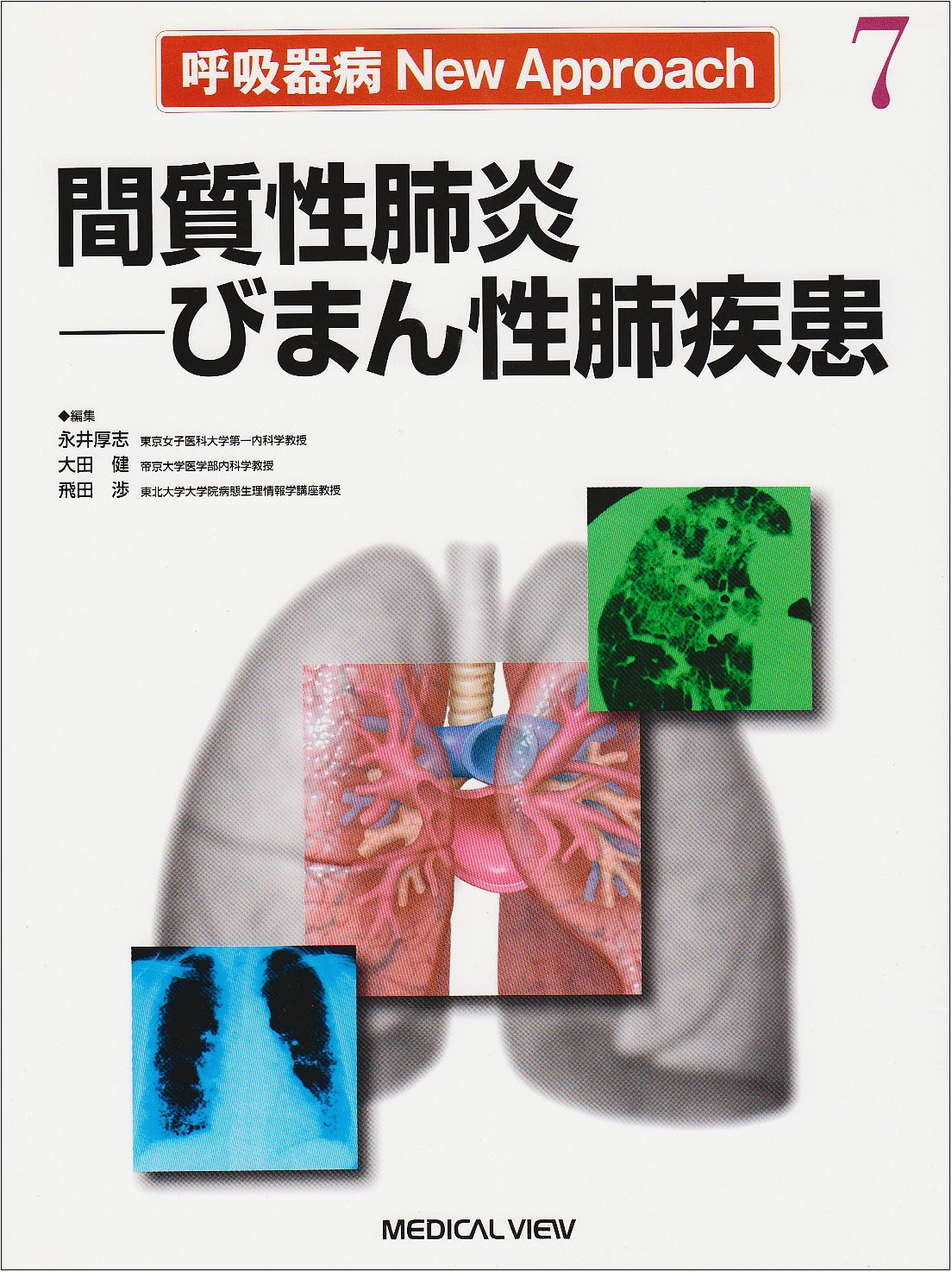 画像から学ぶびまん性肺疾患 Amazon.co.jp: 画像から学ぶびまん性肺疾患 : 酒井 文和: 本